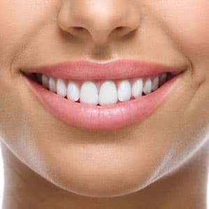 Orthodontics - Improve Your Smile